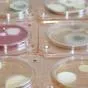 микробиологические экспресс-тесты в Саратове